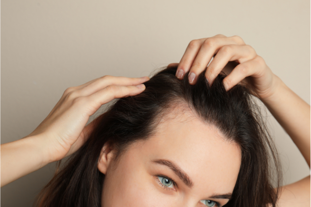 m shaped hairline female