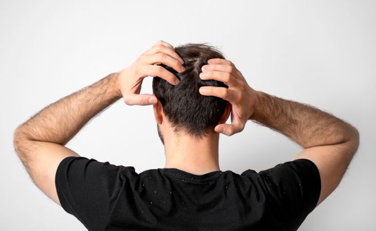 Man inspecting the back of his head for new hair regrowth