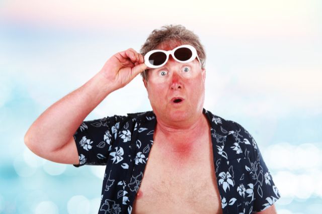scalp sunburn hair loss