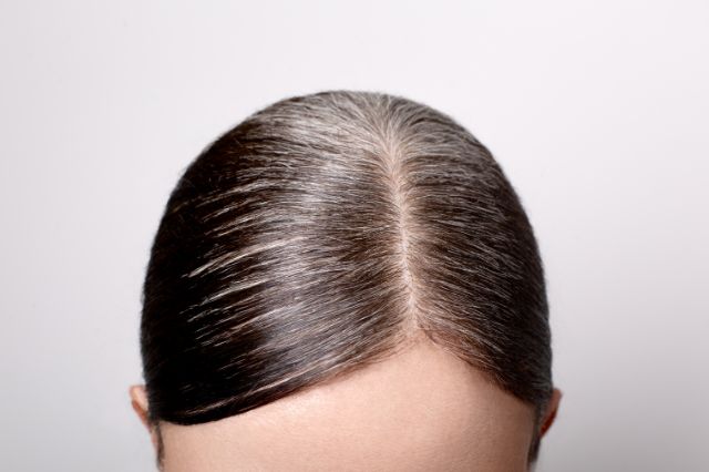 stem cell causing gray hair