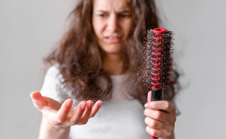 testosterone hair loss