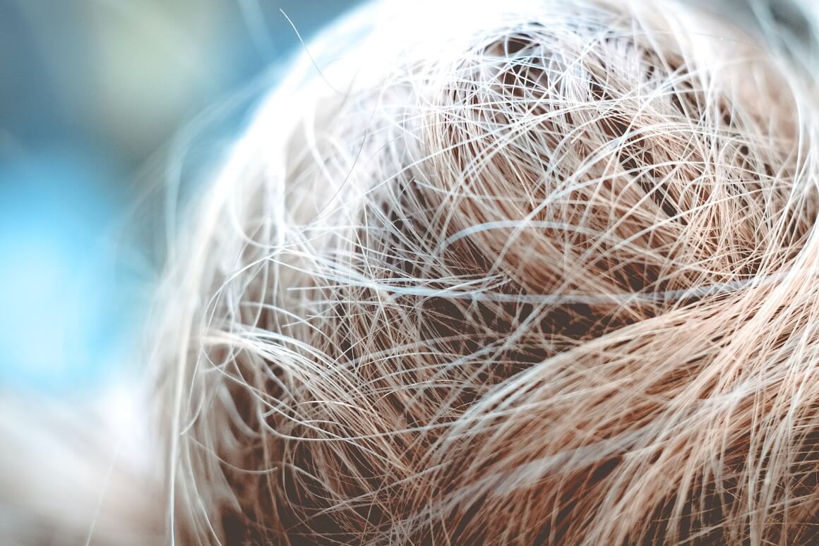 Head of hair viewed from above