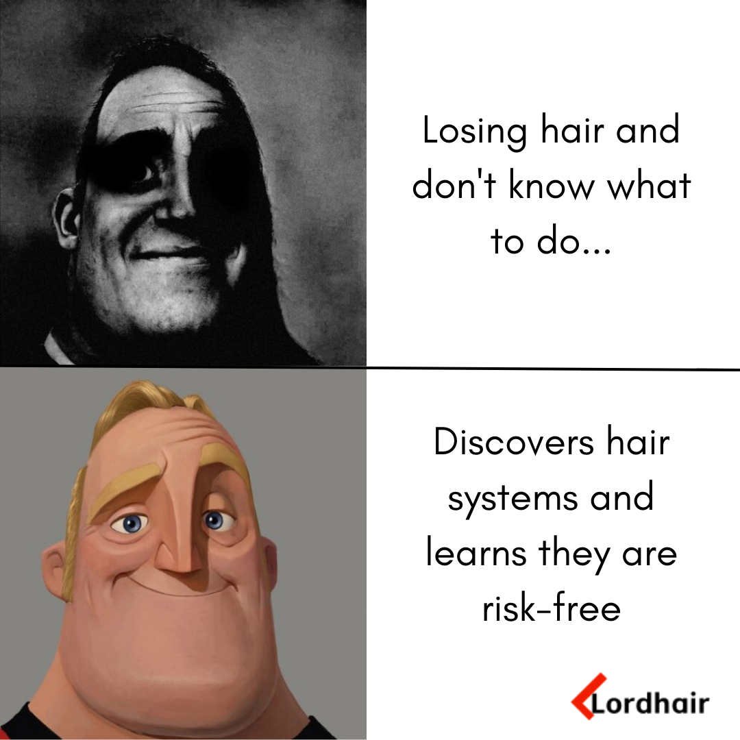 Lordhair meme about toupees as a hair loss solution