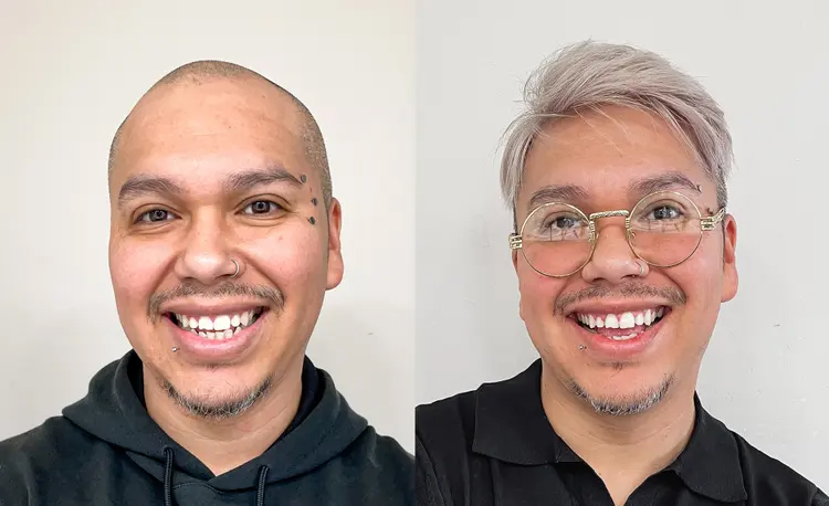 hair system  before and after
