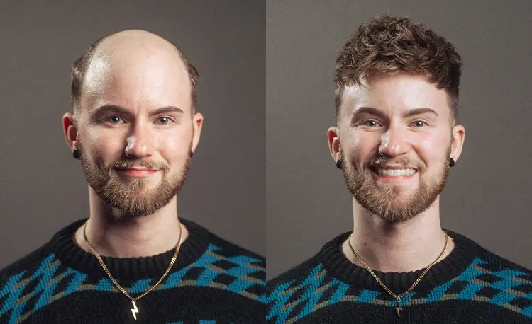 hair system before and after
