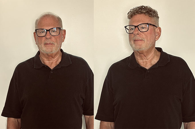 Dr. John's before and after