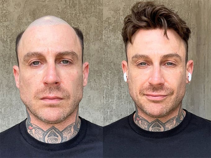 Lordhair user before and after