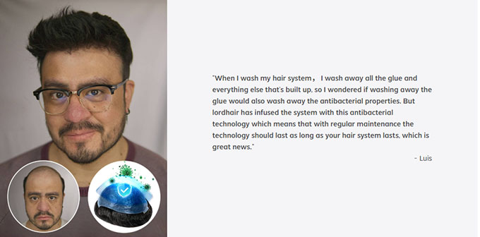 ZyroSen hair system review Luis