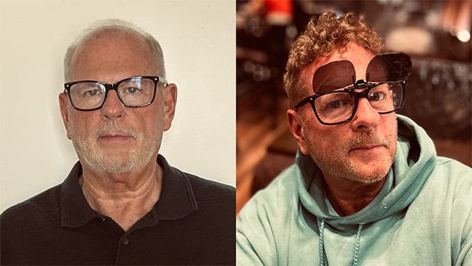 Lordhair hair system before and after