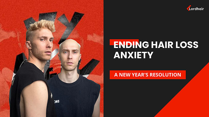 ending hair loss anxiety
