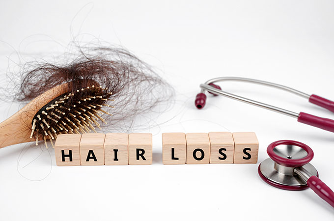 temple hair loss treatment options