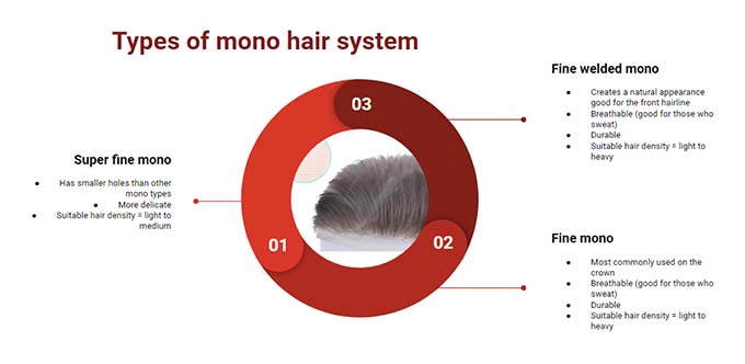 types of mono hair system