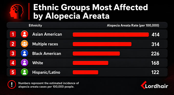 Ethnic Groups Most Affected by Alopecia Areata