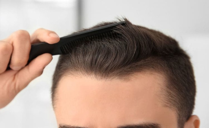 man checking hairline