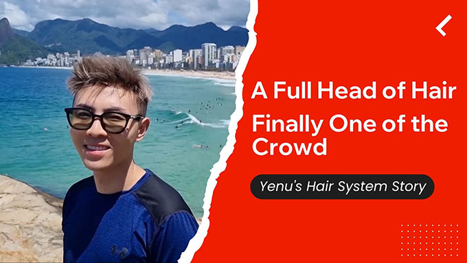 Yenu's Hair system story