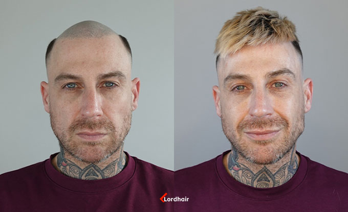 Champion before and after