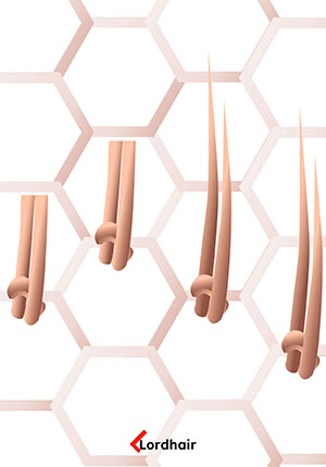 new single split knots