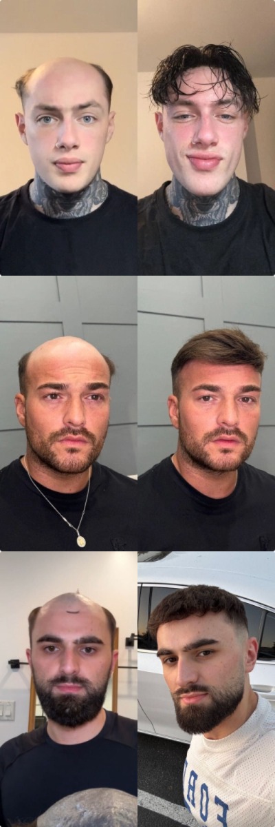 Grid of Lordhair customers' reference photos and their finished hair system results