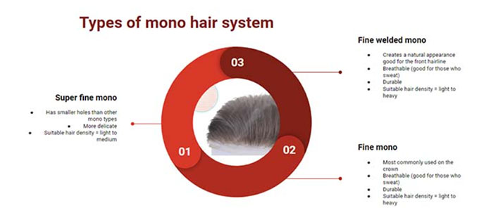 types of mono hair systems