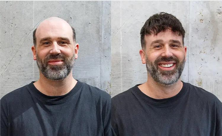 Fringe Haircut with Hair Systems