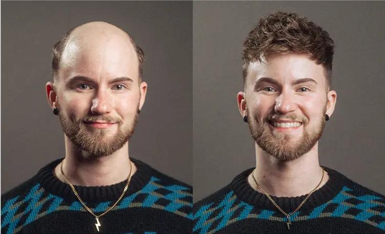 Short and Textured Haircut with Hair Systems