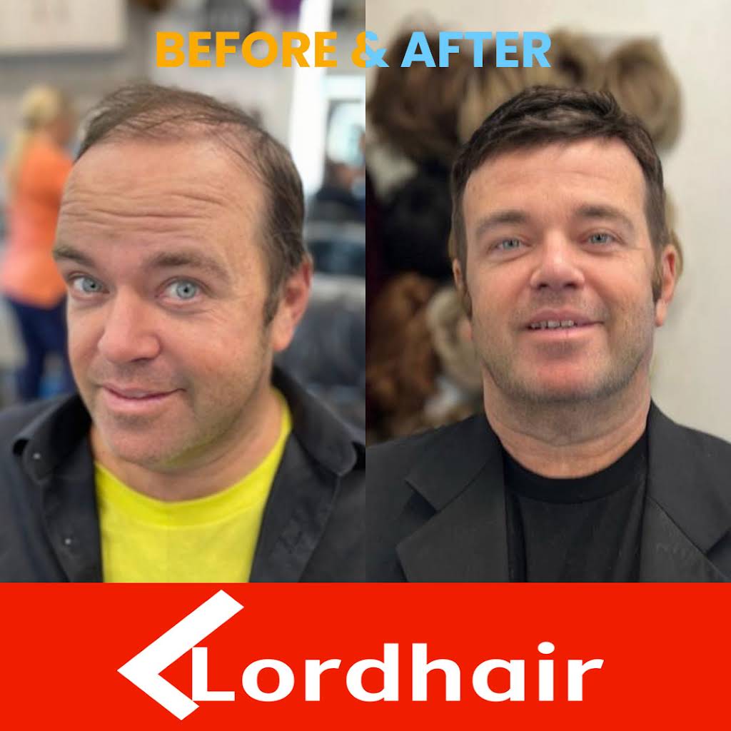 lordhair before and after hair transformation