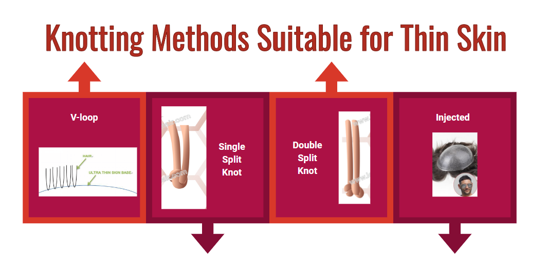 skin hair system knots