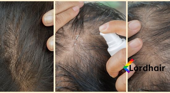 thinning hair women