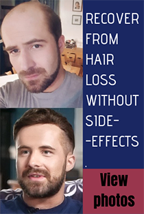 Hair Toupees