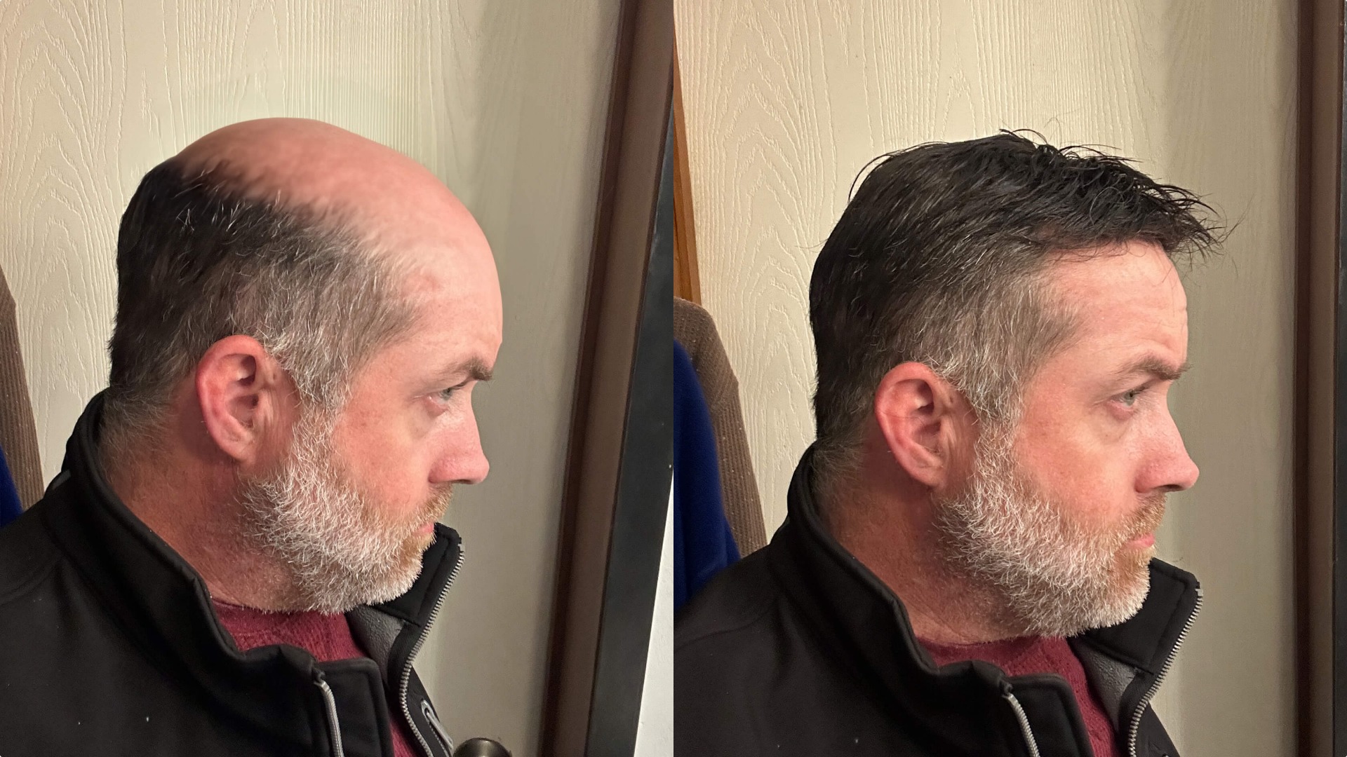 Hybrid Hair System - Multi-functional Design