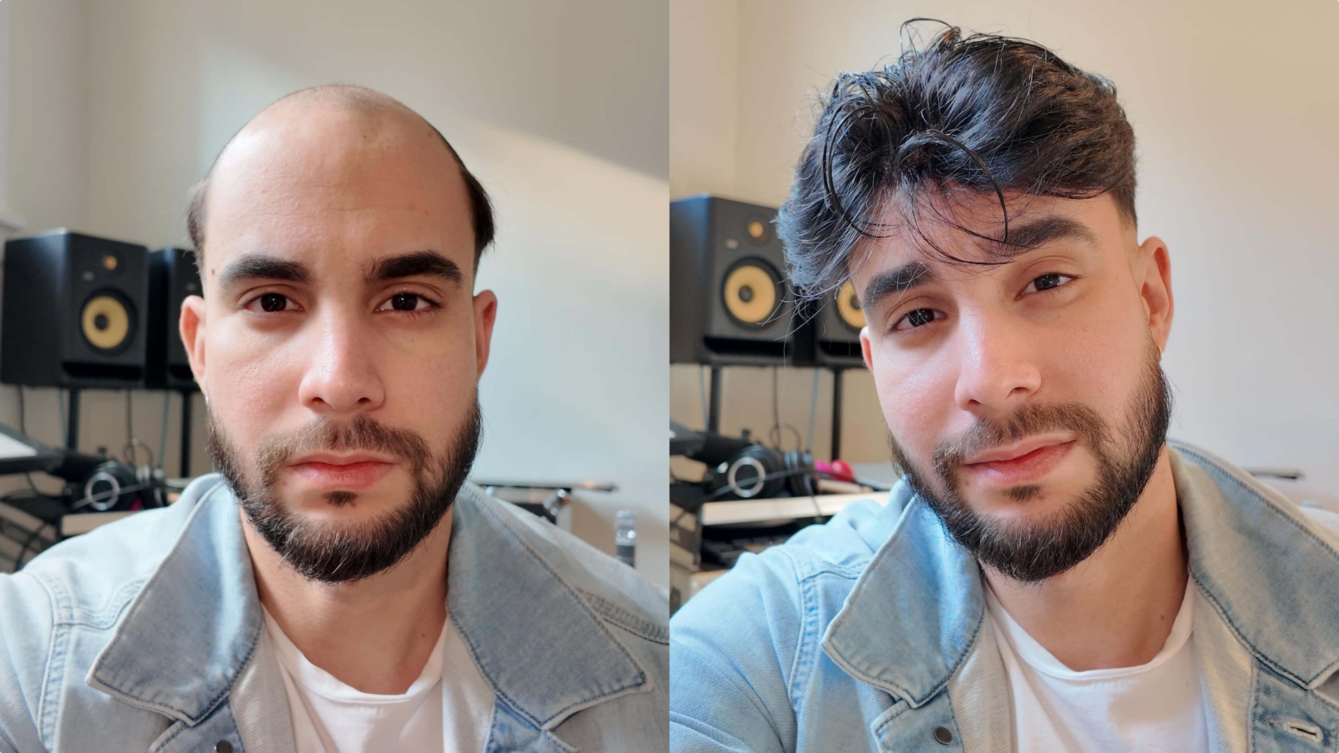 Personalize Mono Hair System