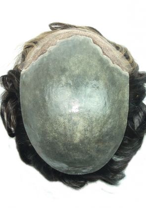 f002 hair replacement system