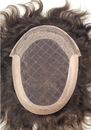 s8 hair replacement system