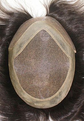 l4 hair replacement system
