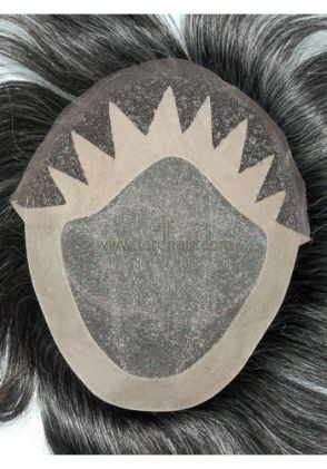 jq556 hair replacement system