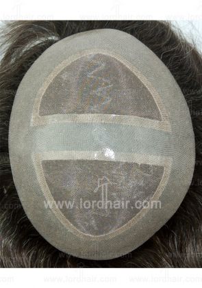 jq540 hair replacement system