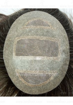 jq543 hair replacement system