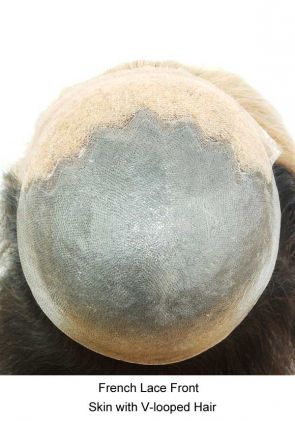 JQ703 Skin Hair Replacement System