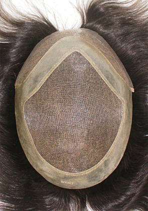 l4 hair replacement system