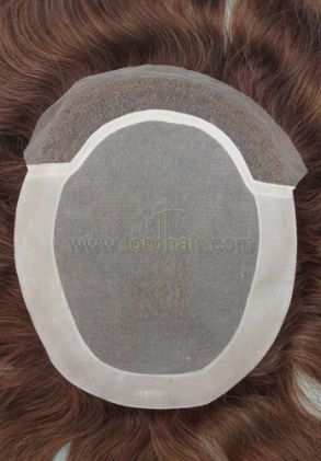 l6 hair replacement system