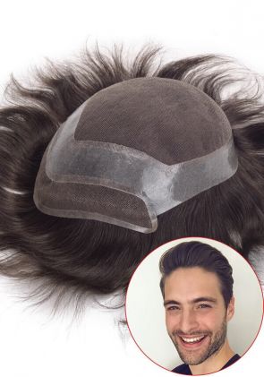 Neo Hair Replacement System for Men