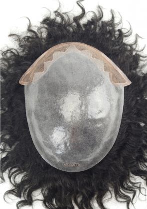 S12 Skin Hair Replacement System