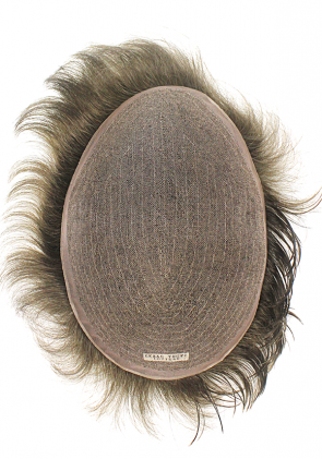 s2 hair replacement system