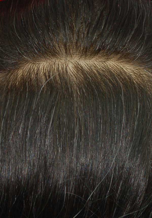 Realistic Super Thin Skin Hair Systems Online Sale | Lordhair Realistic Super Thin Skin Hair Systems Online Sale | Lordhair