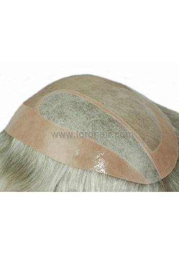 t285 hair replacement system