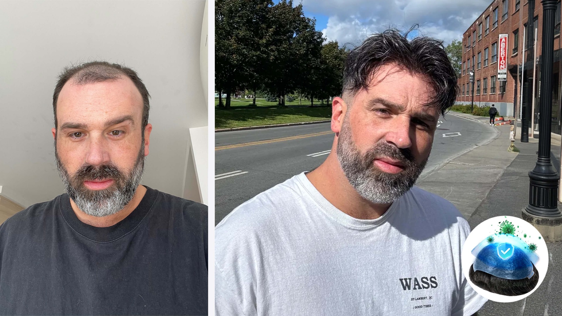 Upgraded Antimicrobial ZyroSen Hair System Essentials for New Users-image-1