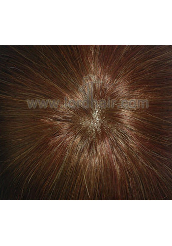 jq1050 hair replacement system