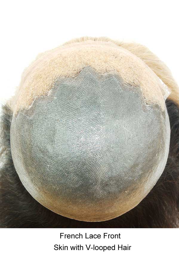 JQ703 Skin Hair Replacement System