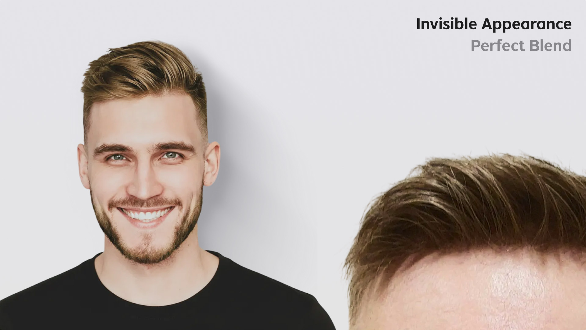 Full French Lace Hair System - Maximum Breathability - Heat-resistant Comfort - Sports-friendly-image-6