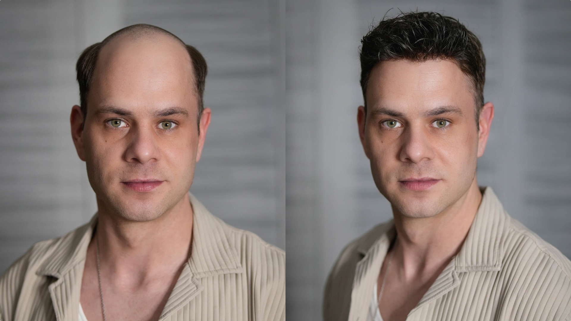 Thin skin before & after look